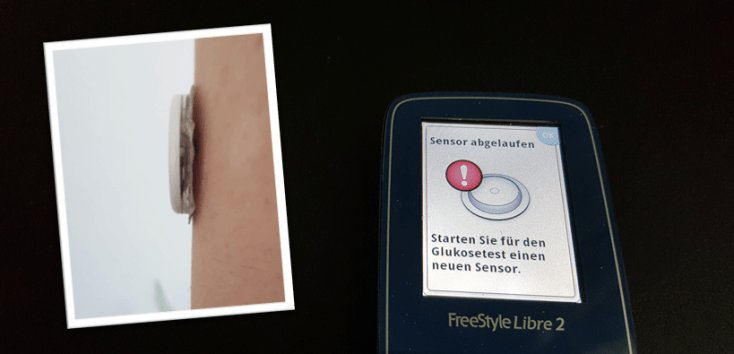 Befestigungen für Freestyle&nbsp;Libre-Sensor